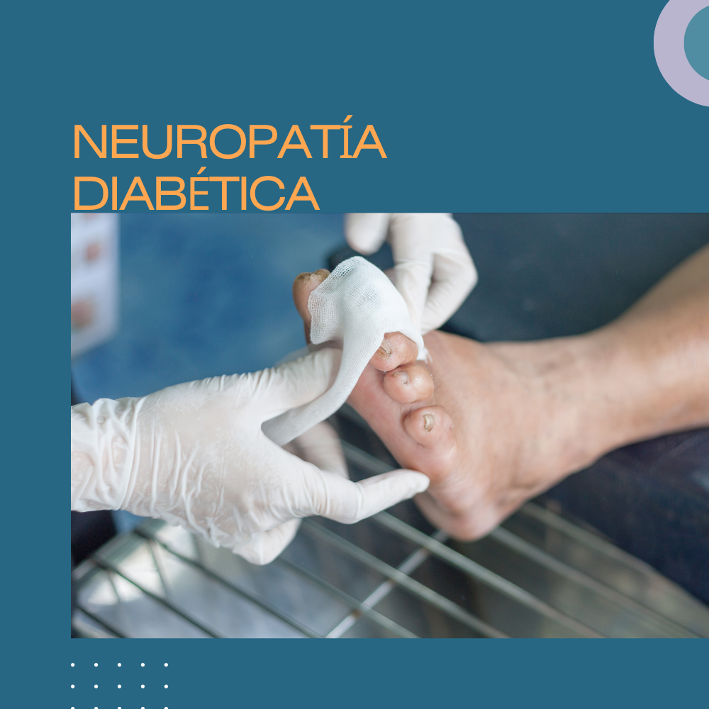 Neuropatía diabética. Presentación