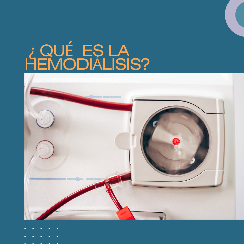 ¿QUÉ ES LA HEMODIÁLISIS?