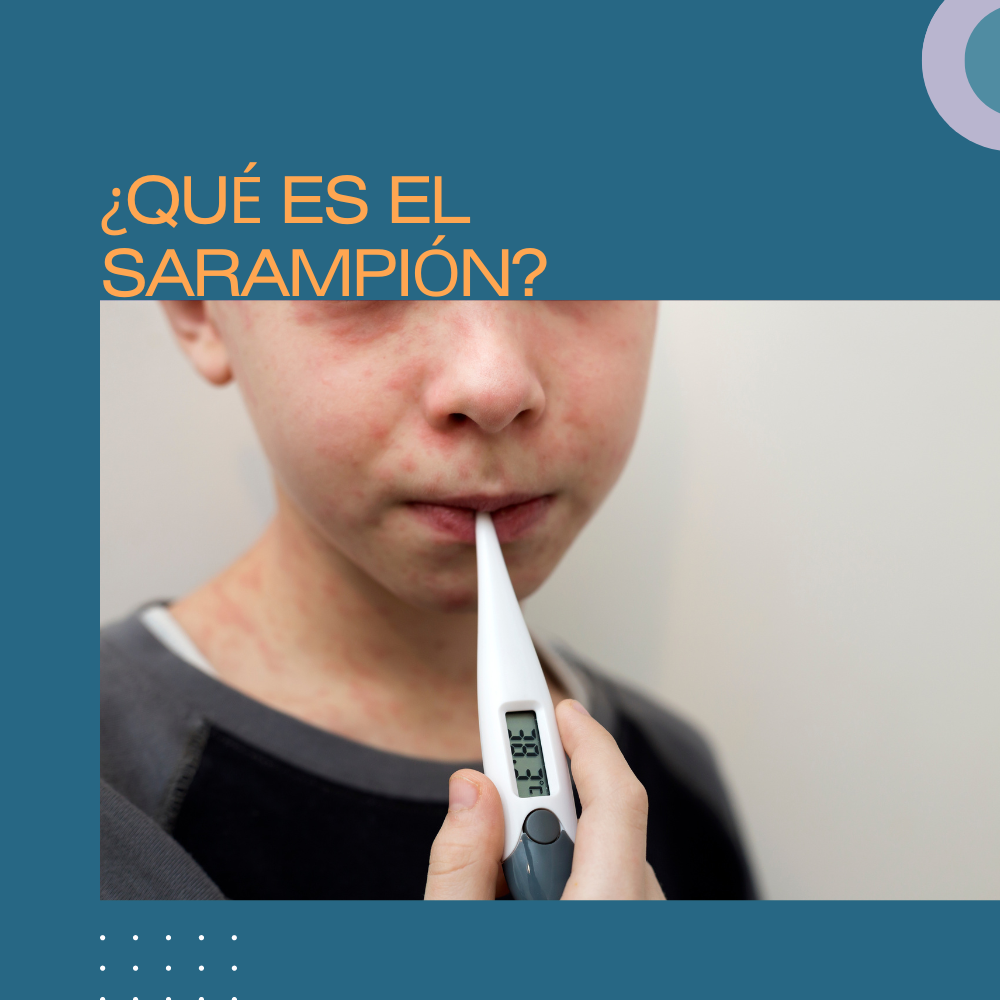 ¿Qué es el sarampión?