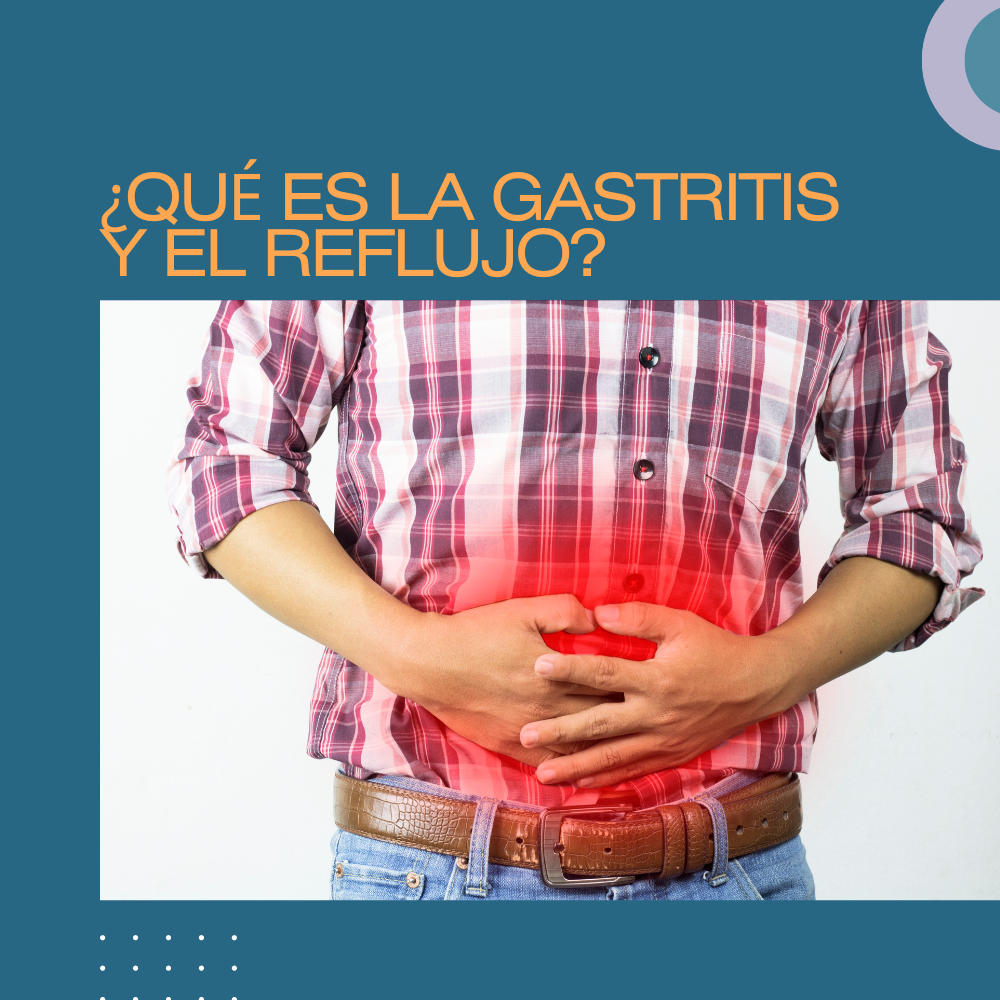 ¿QUÉ ES LA GASTRITIS Y EL REFLUJO?