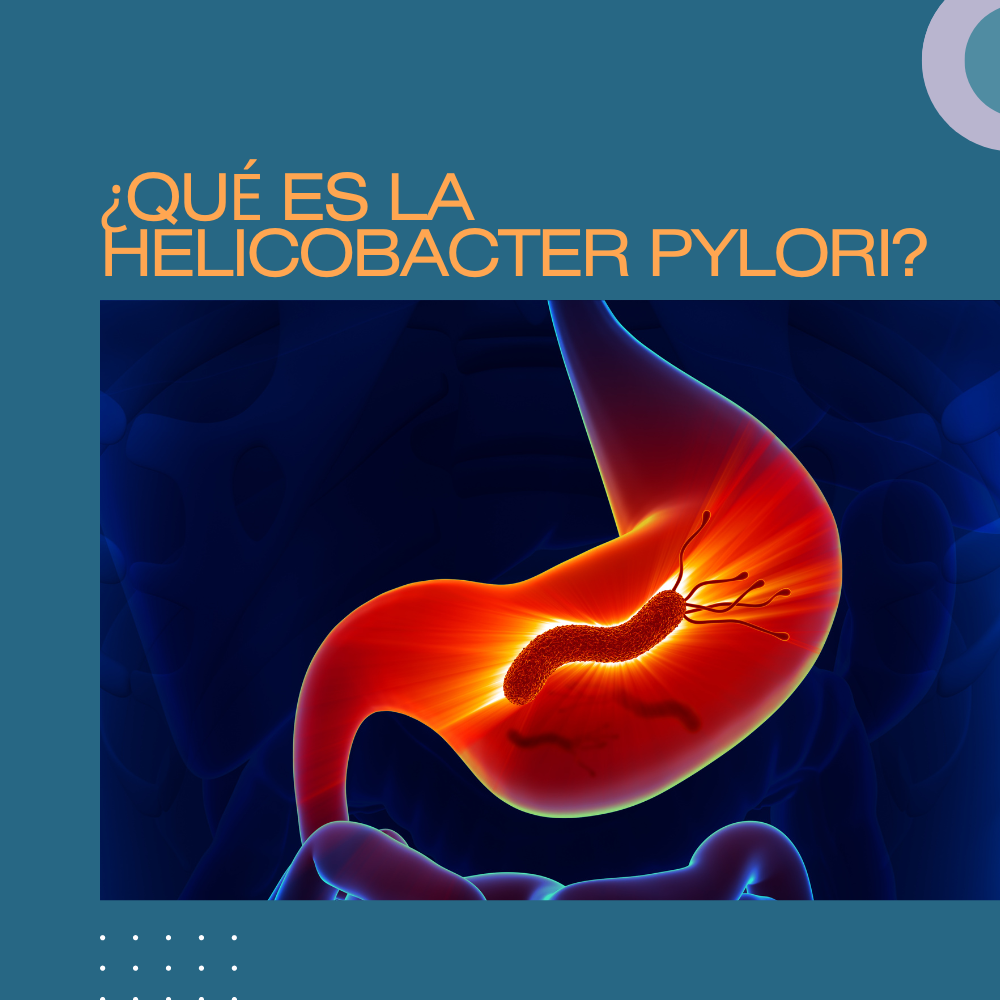 ¿QUÉ ES LA HELICOBACTER PYLORI?