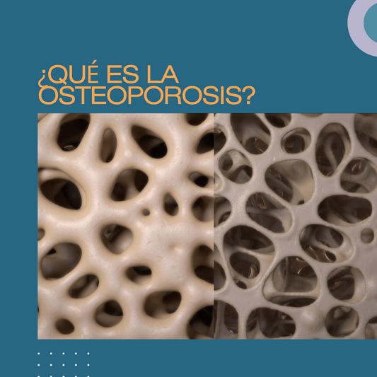 ¿QUÉ ES LA OSTEOPOROSIS?