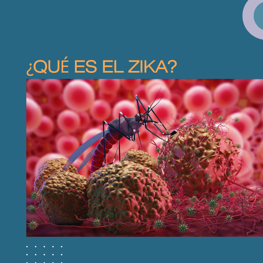 ¿QUÉ ES EL ZIKA?