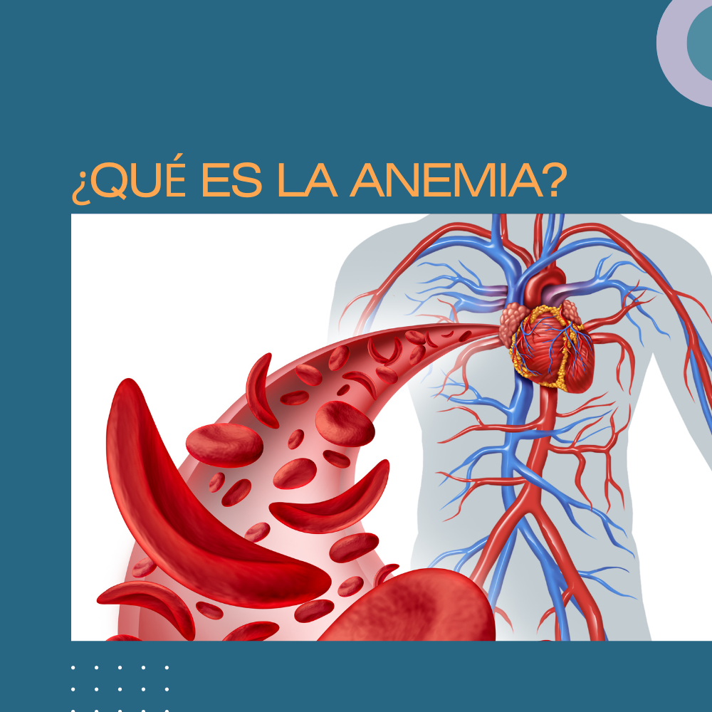 ¿QUÉ ES LA ANEMIA?