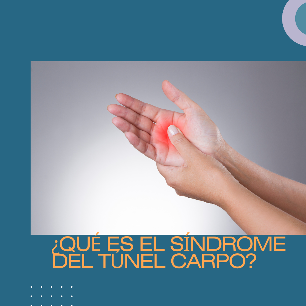 ¿Qué es el síndrome del túnel carpo?